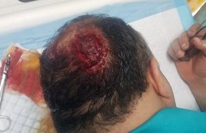 Geólogo es asaltado a pleno día en Mirador Sur