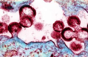 Un nuevo método para prevenir sida tiene más eficacia que el más recomendado