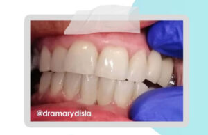 Consejos para cuidar tus encías / Mary Disla