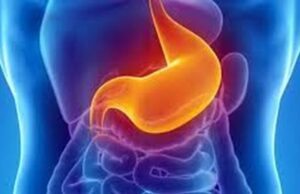 El Silencioso Cáncer de Estómago