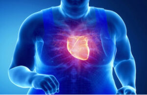 La obesidad dificulta el diagnóstico de las enfermedades cardiovasculares