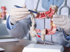 Cada vez más adultos jóvenes son diagnosticados con cánceres gastrointestinales