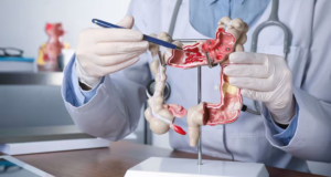 Cada vez más adultos jóvenes son diagnosticados con cánceres gastrointestinales