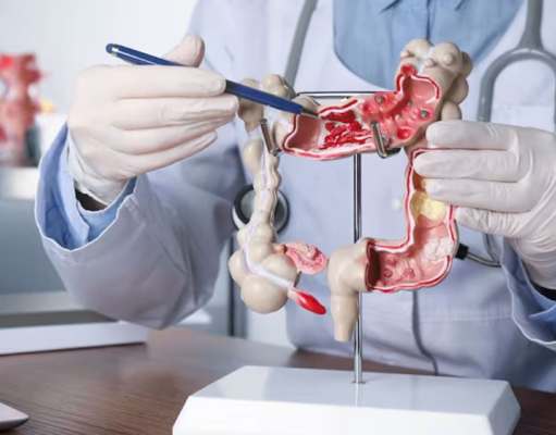 Cada vez más adultos jóvenes son diagnosticados con cánceres gastrointestinales