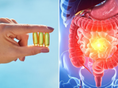La vitamina D podría ayudar a regular la respuesta inmunitaria en personas con enfermedad inflamatoria intestinal