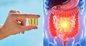 La vitamina D podría ayudar a regular la respuesta inmunitaria en personas con enfermedad inflamatoria intestinal