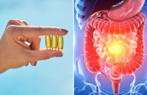 La vitamina D podría ayudar a regular la respuesta inmunitaria en personas con enfermedad inflamatoria intestinal