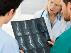 ¿Un tumor óseo siempre significa cáncer? Esto es lo que hay que saber
