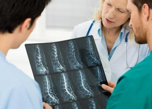 ¿Un tumor óseo siempre significa cáncer? Esto es lo que hay que saber