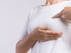 El cáncer de mama inflamatorio puede avanzar rápidamente y a menudo no presenta un bulto como señal de alerta